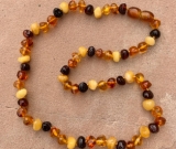 Baltic Amber Adult/Adolescent Necklace - Perfectly Imperfect Larger Beads Polished Unique 4 Diffe Baltic Amber Adult/Adolescent Necklace - Perfectly Imperfect Larger Beads Polished Unique 4 Diffe