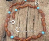 NEW! Baltic Amber Anklet - AdjustableUnpolished Blue Cider