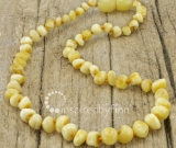 SALE - Kids Amber Teething Necklace - Polished Variegated - Sizes 10.5-15