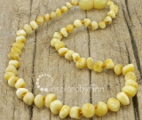 Kids Amber Teething Necklace - Polished Variegated - Sizes 10.5-15