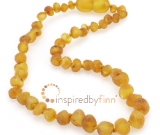 Baltic Amber Clasped AnkletUnpolished Harvest