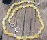 NEW! Baltic Amber Anklet - AdjustableUnpolished Lemon Rose Quartz