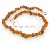 Baltic Amber Anklet - AdjustableUnpolished Cider