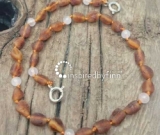 Baltic Amber Anklet - AdjustableUnpolished Cider Rose Quartz