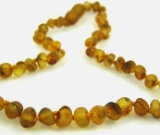 Amber Necklace - Unpolished Spotted Amber - Sizes 10.5 - 18